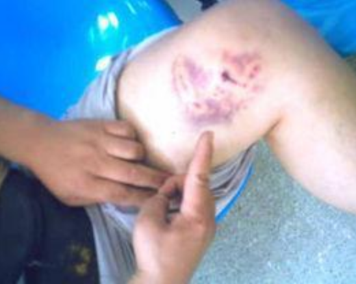 飼養(yǎng)動物損害責(zé)任