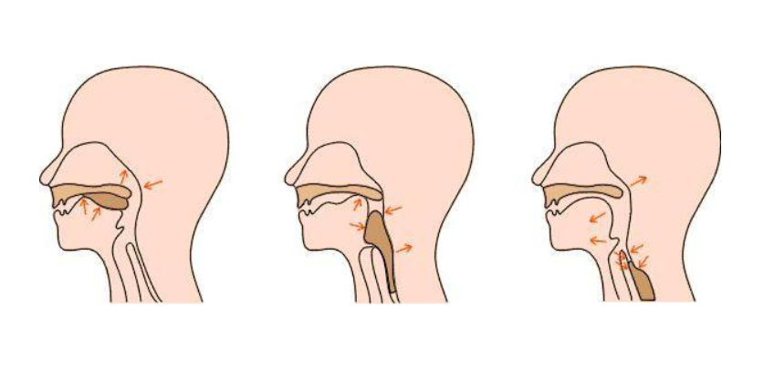 吞咽反射(吞咽反射)_尚可名片